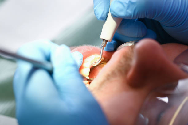 Best Emergency Dental Services for Seniors in Catonsville, MD